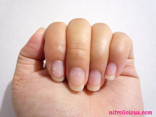 Removing Calgel