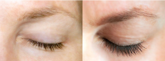 Lash Allure MD on GILT